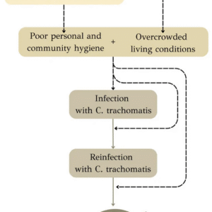 Trachoom behandeling medicijnen en oogdruppels.