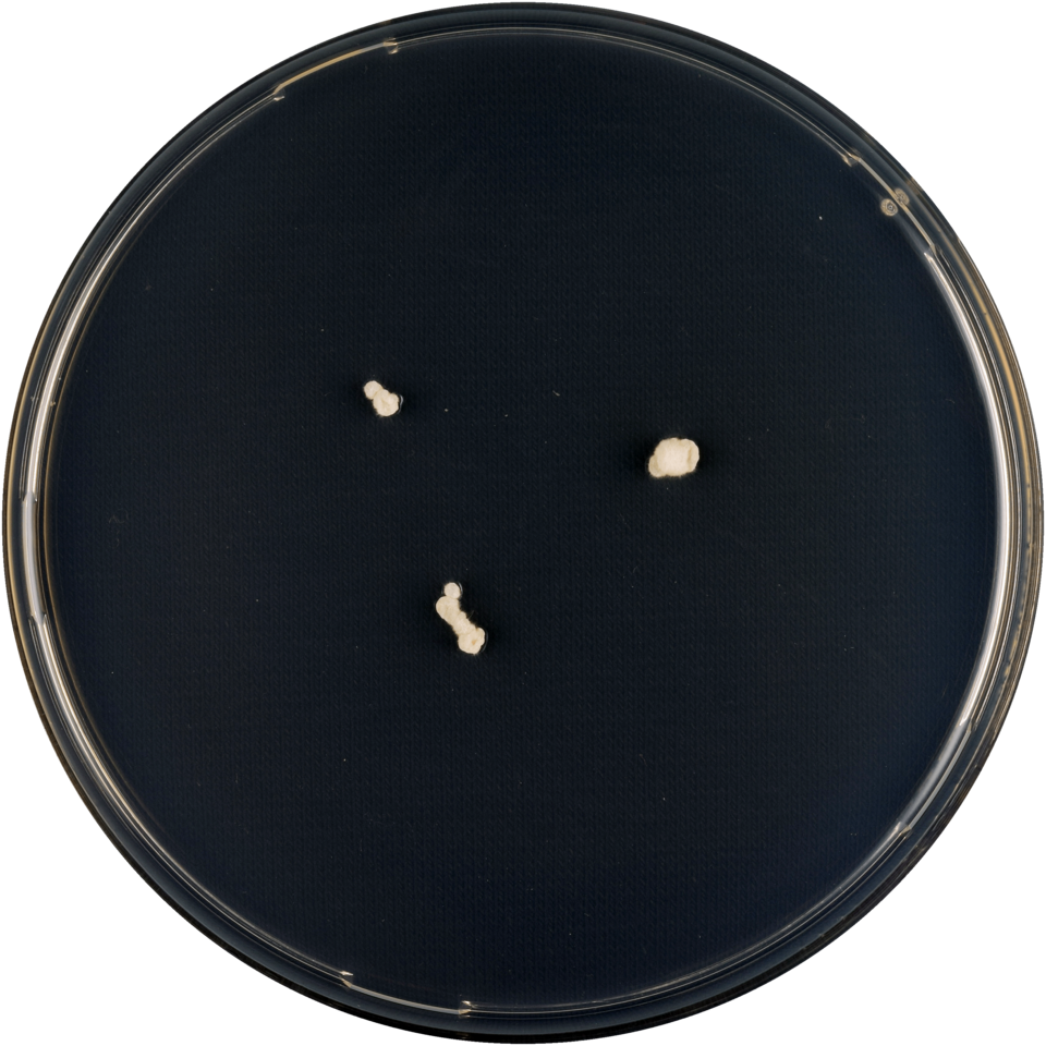 Geel Aspergillus conicus op voedingsbodem, cilindervormige conidiophoren.