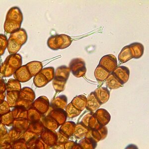 Teliosporen van Puccinia helianthi op zonnebloemblad.
