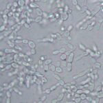 Debaryomyces hansenii gistcel in nat preparaat - microbiële cel.