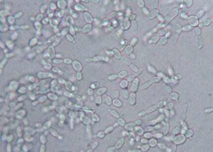 Debaryomyces hansenii gistcel in nat preparaat - microbiële cel.