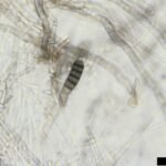 Thielaviopsis basicola op plantenblad, schimmelinfectie close-up.